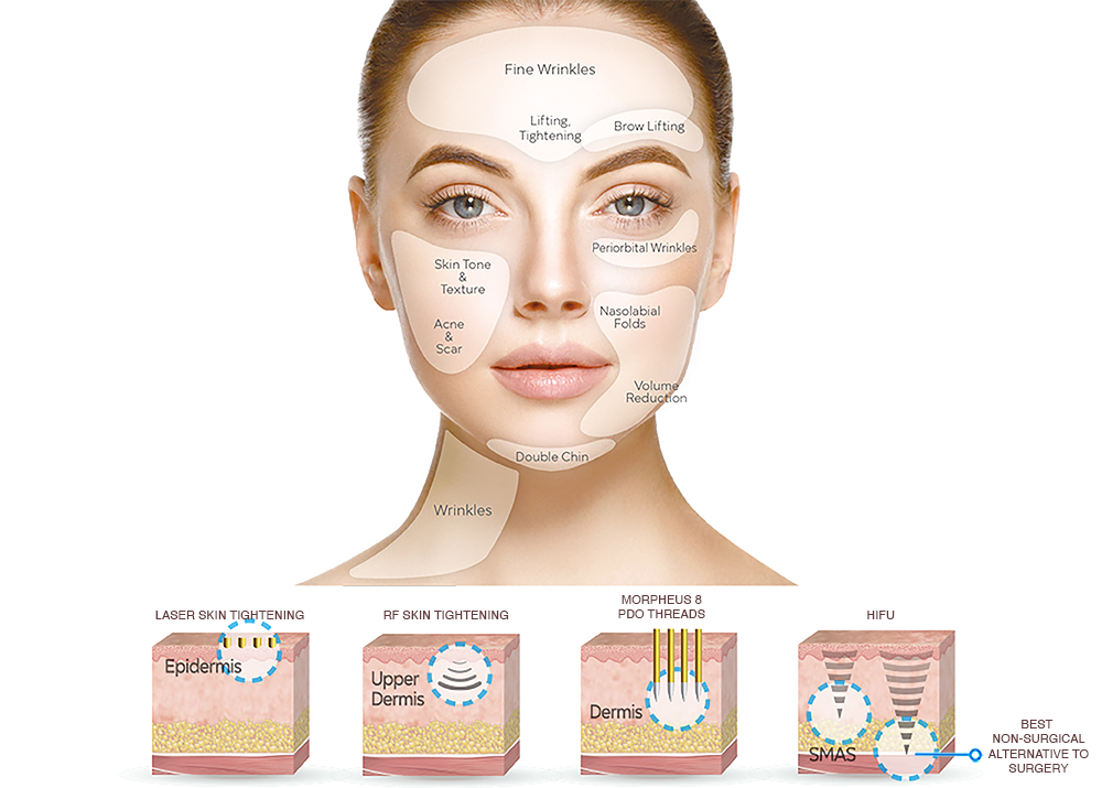 The Incredible Benefits of a Non-Surgical Facelift with HIFU Technology